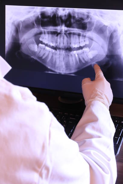 Best Emergency Wisdom Tooth Extraction in Dovesville, SC