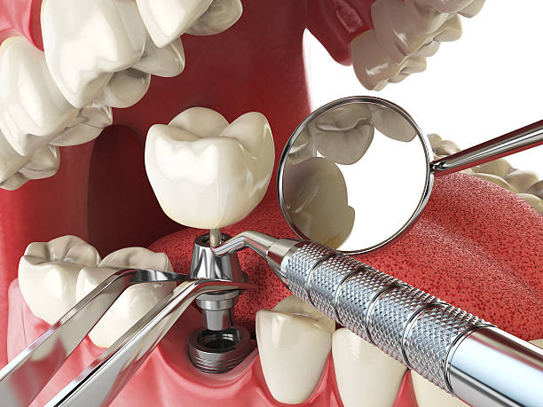 Best Walk-In Emergency Dental Services in Dovesville, SC